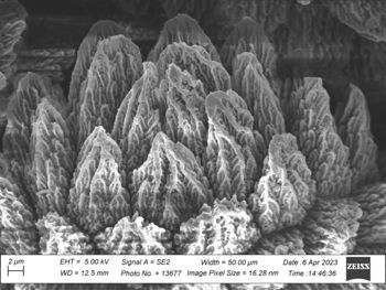 Media type: image;   Invertebrate Zoology 32029 Description: SEM image of specimen.;  Aspect: dorsal
